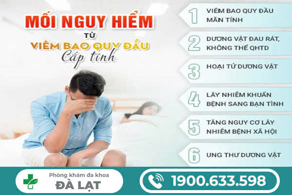 Hình ảnh minh họa